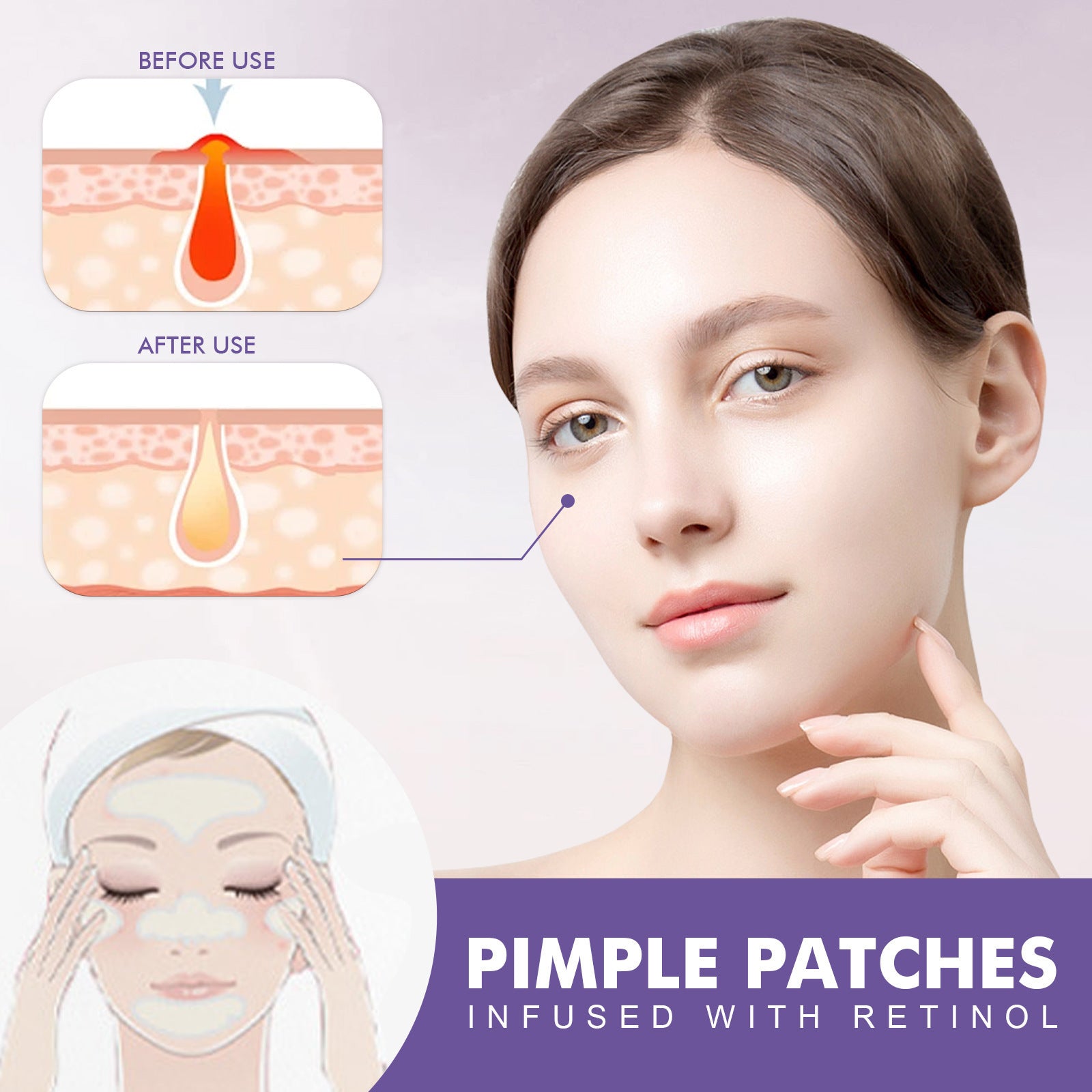Cheek Acne Patch Anti-acne Smallpox Diluting Acne